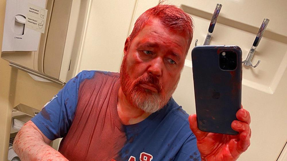 Der russische Nobelpreisträger sagte, er sei mit roter Farbe angegriffen worden